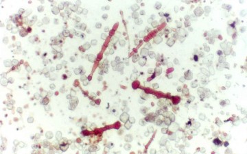 Silent classroom killer? 75% of schools contain deadly asbestos says report